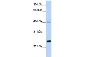 HSPB8 antibody used at 1 ug/ml to detect target protein. (HSPB8 antibody  (N-Term))
