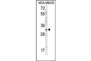 Western blot analysis in of DTWD1 Antibody (Center) Cat. (DTWD1 antibody  (Middle Region))