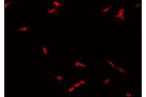 ABIN6266775 staining NCI-H929 cells by IF/ICC. (FOXH1 antibody  (Internal Region))