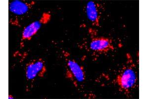 Proximity Ligation Analysis of protein-protein interactions between PIK3R1 and CTNNB1. (CTNNB1 antibody  (AA 682-781))