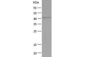 Western Blotting (WB) image for Acyl-CoA Dehydrogenase Family, Member 8 (Acad8) (AA 23-415) protein (His tag) (ABIN7121677) (Acad8 Protein (AA 23-415) (His tag))
