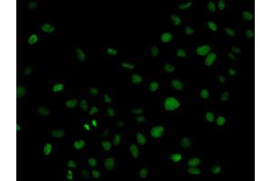 Immunofluorescence (IF) image for anti-Phospholipase C gamma 2 (PLCG2) (AA 1-300) antibody (ABIN3023145)