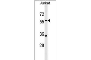 NX1 Antibody (Center) (ABIN1537796 and ABIN2848757) western blot analysis in Jurkat cell line lysates (35 μg/lane). (PANX1 antibody  (AA 124-152))