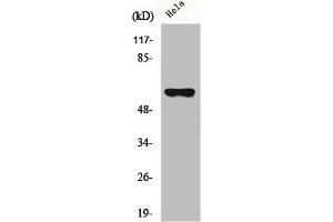 Western Blot analysis of HeLa cells using CYP27A1 Polyclonal Antibody (CYP27A1 antibody  (Internal Region))