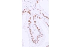 Immunohistochemistry (IHC) image for anti-Tumor Protein P53 Binding Protein 1 (TP53BP1) (AA 350-400) antibody (ABIN7448396) (TP53BP1 antibody  (AA 350-400))