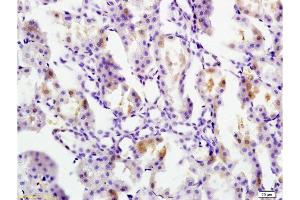 Formalin-fixed and paraffin embedded rat kidney tissue labeled with Anti Ferritin Polyclonal Antibody, Unconjugated  at 1:200 followed by conjugation to the secondary antibody and DAB staining (FTH1 antibody  (AA 1-100))