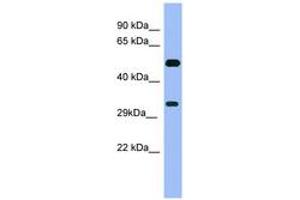 Image no. 1 for anti-Melanoma Antigen Family B, 1 (MAGEB1) (C-Term) antibody (ABIN6741714)