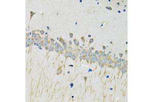 Immunohistochemistry of paraffin-embedded mouse brain using SERPINA4 antibody (ABIN4905121) at dilution of 1:100 (40x lens). (SERPINA4 antibody)