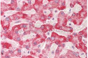 Rabbit Anti-HADH antibody Catalog Number: ARP54764 Formalin Fixed Paraffin Embedded Tissue: Human Adult Liver  Observed Staining: Cytoplasm in hepatocytes Primary Antibody Concentration: 1:600 Secondary Antibody: Donkey anti-Rabbit-Cy3 Secondary Antibody Concentration: 1:200 Magnification: 20X Exposure Time: 0. (HADH antibody  (Middle Region))