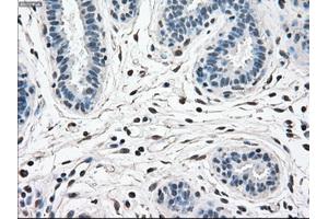 Immunohistochemical staining of paraffin-embedded breast tissue using anti-MAPK1 mouse monoclonal antibody. (ERK2 antibody)