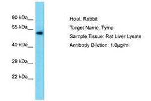 Image no. 1 for anti-Thymidine Phosphorylase (TYMP) (AA 89-138) antibody (ABIN6750314) (Thymidine Phosphorylase antibody  (AA 89-138))