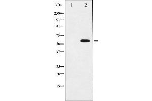 Western blot analysis of p56 Dok-2 expression in K562 whole cell lysates,The lane on the left is treated with the antigen-specific peptide. (DOK2 antibody  (Internal Region))