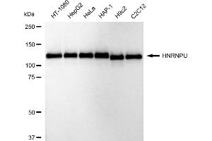 Western blotting analysis using HNRNPU antibody (ABIN7798902).