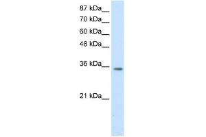 WB Suggested Anti-HOXD4 Antibody Titration:  1. (HOXD4 antibody  (C-Term))