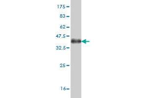 Western Blot detection against Immunogen (36. (ABL2 antibody  (AA 743-842))