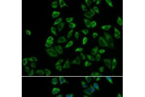 Immunofluorescence analysis of HeLa cells using PEX5 Polyclonal Antibody