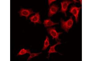ABIN6277137 staining Hela by IF/ICC. (ATF2 antibody  (N-Term))