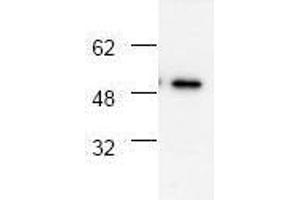 Image no. 1 for anti-Tumor Necrosis Factor Receptor Superfamily, Member 1A (TNFRSF1A) antibody (ABIN127018)