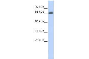 WB Suggested Anti-UGT2B15 Antibody Titration:  0. (UGT2B15 antibody  (N-Term))