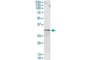 ORM1 MaxPab rabbit polyclonal antibody. (ORM1 antibody  (AA 1-201))