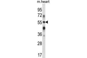 Western Blotting (WB) image for anti-UDP-Gal:betaGlcNAc beta 1,3-Galactosyltransferase, Polypeptide 2 (B3GALT2) antibody (ABIN2998023) (B3GALT2 antibody)