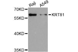 Western blot analysis of extracts of various cell lines, using KRT81 antibody (ABIN5972115) at 1:3000 dilution.
