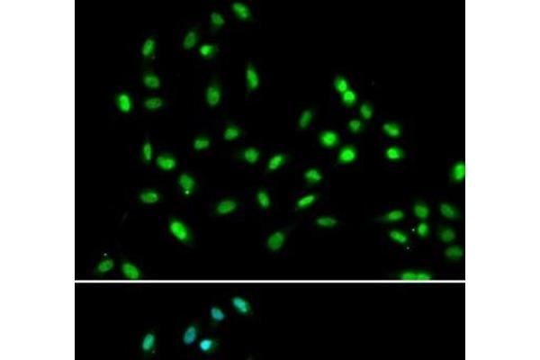 SMARCAD1 antibody