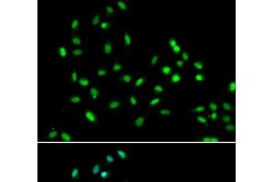 Immunofluorescence analysis of A549 cells using SMARCAD1 Polyclonal Antibody (SMARCAD1 antibody)