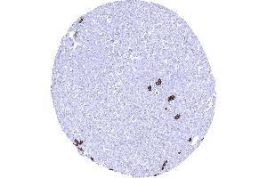 Liver Strong Trop 2 staining in intrahepatic bile ducts of the liver (Recombinant TACSTD2 antibody  (AA 31-274))