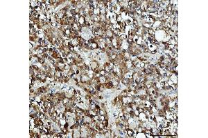 IHC analysis of XTP3TPA/DCTPP1 using anti-XTP3TPA/DCTPP1 antibody (ABIN7600677). (DCTPP1 antibody  (AA 22-170))