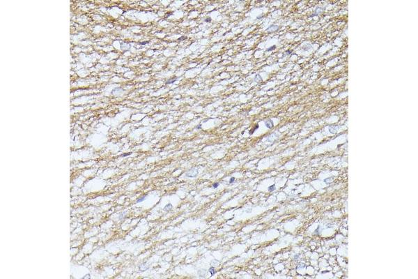 Septin 5 antibody  (AA 1-369)