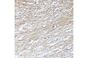 Immunohistochemistry of paraffin-embedded rat brain using Septin 5 antibody (ABIN6128759, ABIN6147556, ABIN6147557 and ABIN6216776) at dilution of 1:100 (40x lens). (Septin 5 antibody  (AA 1-369))