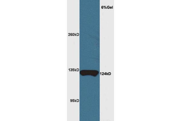 Chromosome 11open Reading Frame 9 (C11orf9) (AA 401-500) anticorps