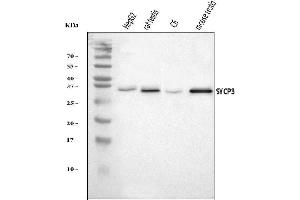 Western blot analysis of SCP3/SYCP3 using anti-SCP3/SYCP3 antibody (ABIN7602415).