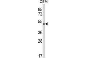 Western blot analysis of KMO Antibody (Center) in CEM cell line lysates (35ug/lane).