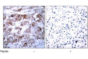 Image no. 3 for anti-B-Cell CLL/lymphoma 2 (BCL2) (Ser70) antibody (ABIN197205) (Bcl-2 antibody  (Ser70))