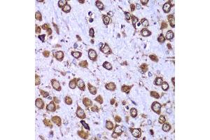 Immunohistochemistry of paraffin-embedded mouse brain using RPS10 antibody (ABIN6132945, ABIN6147192, ABIN6147194 and ABIN6221686) at dilution of 1:100 (40x lens). (RPS10 antibody  (AA 1-165))