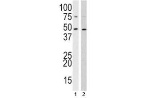 Western blot analysis of SUV39H2 antibody and 1) 293, 2) HL-60 lysate (SUV39H2 antibody  (AA 360-390))