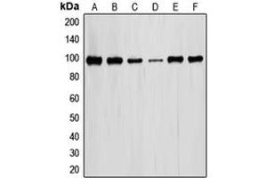 Western blot analysis of STAT6 expression in MCF7 (A), HeLa (B), HT29 (C), RAW246. (STAT6 antibody  (Center))