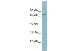 WB Suggested Anti-SLC27A5 Antibody Titration:  0. (SLC27A5 antibody  (Middle Region))
