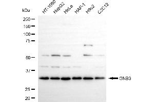anti-Guanine Nucleotide Binding Protein (G Protein), beta Polypeptide 3 (GNB3) antibody