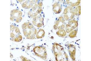 Immunohistochemistry of paraffin-embedded Human stomach using PER1 Polyclonal Antibody at dilution of 1:100 (40x lens).