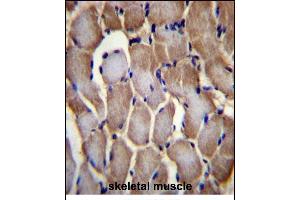 SEPN1 Antibody (C-term) (ABIN656385 and ABIN2845680) immunohistochemistry analysis in formalin fixed and paraffin embedded human skeletal muscle followed by peroxidase conjugation of the secondary antibody and DAB staining.