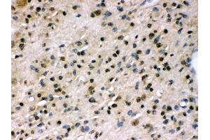 Anti- PPP1R12A Picoband antibody,IHC(P) IHC(P): Human Glioma Tissue (PPP1R12A antibody  (N-Term))