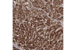 Immunohistochemical staining of human adrenal gland with LACTB polyclonal antibody  shows strong cytoplasmic positivity in cortical cells at 1:50-1:200 dilution. (LACTB antibody)