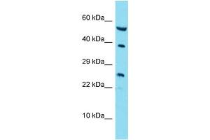 Host: Rabbit Target Name: RAB42 Sample Type: A549 Whole Cell lysates Antibody Dilution: 1. (RAB42 antibody  (C-Term))