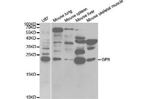Western blot analysis of extracts of various cell lines, using GP9 antibody (ABIN5973110) at 1/1000 dilution. (CD42a antibody)