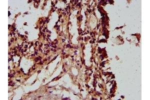 IHC image of ABIN7164423 diluted at 1:300 and staining in paraffin-embedded human lung tissue performed on a Leica BondTM system.
