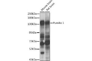 Western blot analysis of extracts of various cell lines, using Pumilio 1 antibody  at 1:1000 dilution. (PUM1 antibody  (AA 1-280))
