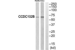 Western Blotting (WB) image for anti-Coiled-Coil Domain Containing 102B (CCDC102B) (Internal Region) antibody (ABIN1851142) (CCDC102B antibody  (Internal Region))